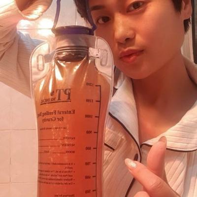 Thụt tháo đại tràng theo lộ trình